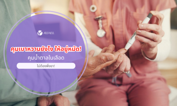 คุมเบาหวาน โดยไม่ต้องพึ่งยา