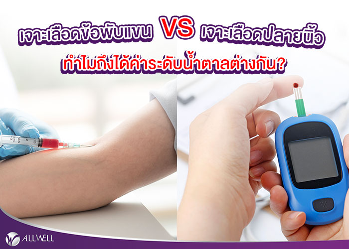 ตรวจน้ำตาลในเลือด เจาะเลือดปลายนิ้ว Vs เจาะข้อพับแขน ทำไมได้ค่าต่างกัน?