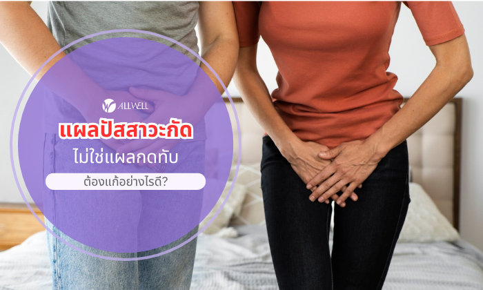 แผลปัสสาวะกัด ไม่ใช่แผลกดทับ