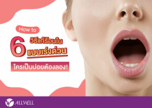 วิธีแก้ร้อนในเร่งด่วน