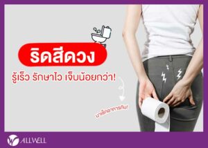 อาการริดสีดวง เริ่มแรก