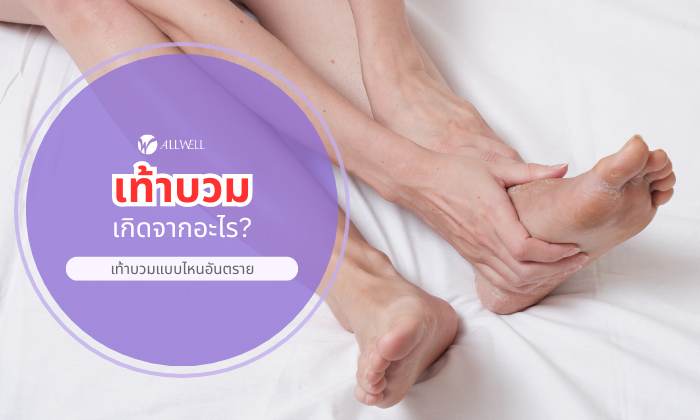 เท้าบวม เกิดจาก