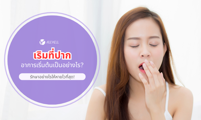 เริมที่ปาก