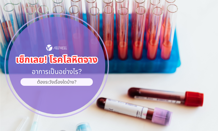 เช็กเลย! โรคโลหิตจาง
