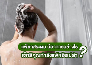 แพ้ยาสระผม