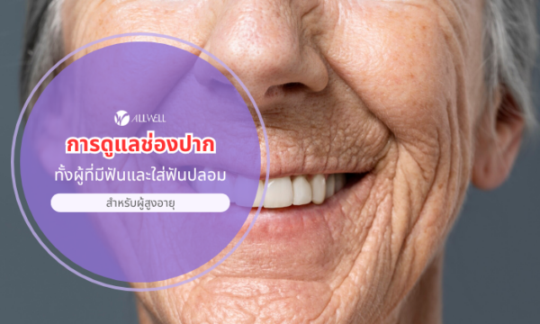 การดูแลช่องปาก