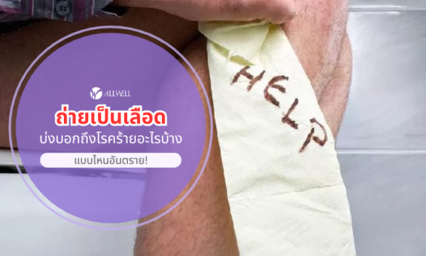 ถ่ายเป็นเลือด