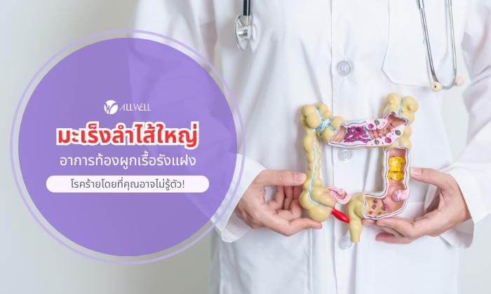 มะเร็งลำไส้ใหญ่