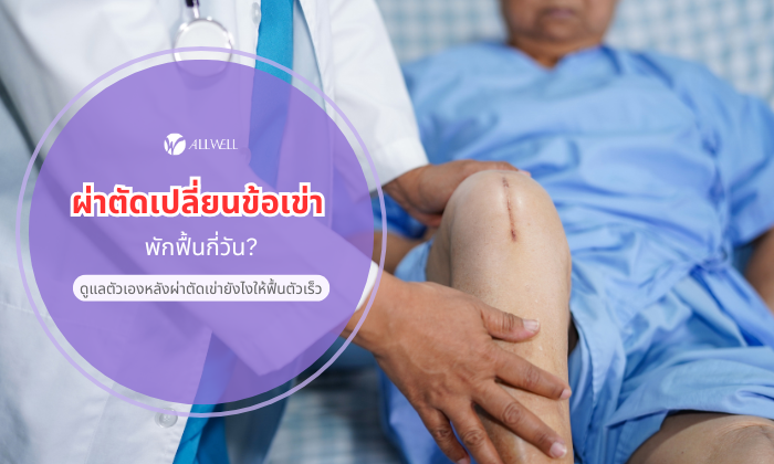 ผ่าตัดเปลี่ยนข้อเข่า พักฟื้นกี่วัน? ดูแลตัวเองหลังผ่าตัดเข่ายังไงให้ฟื้นตัวเร็ว