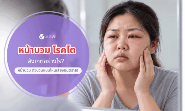 อาการหน้าบวม