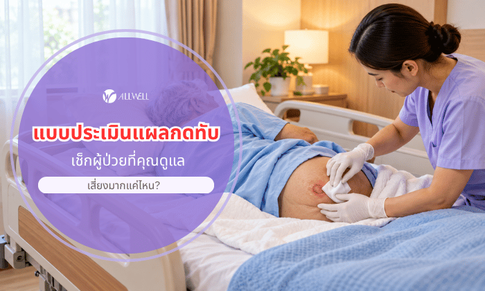 แผลกดทับ